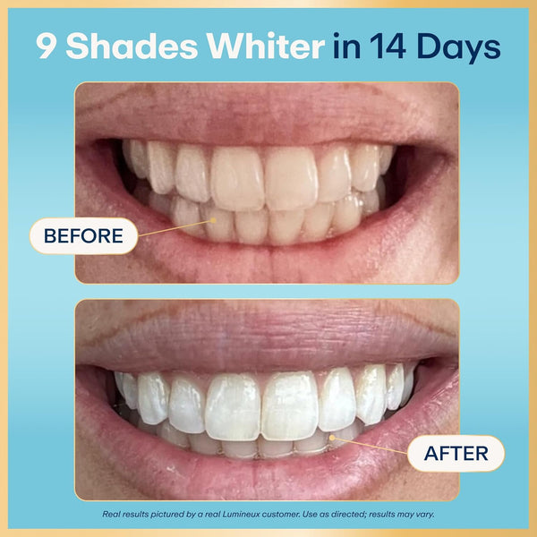 Lumineux Bright Smile Kit