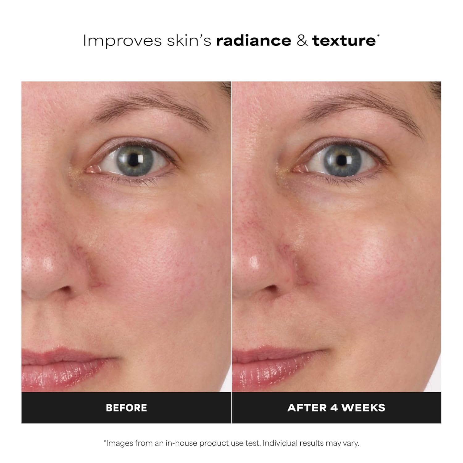 Clear Skin Balancing Toner