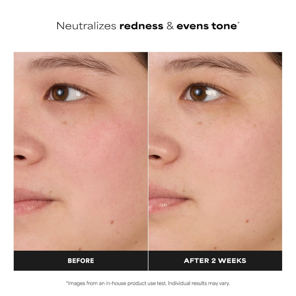 Clear Skin Balancing Toner