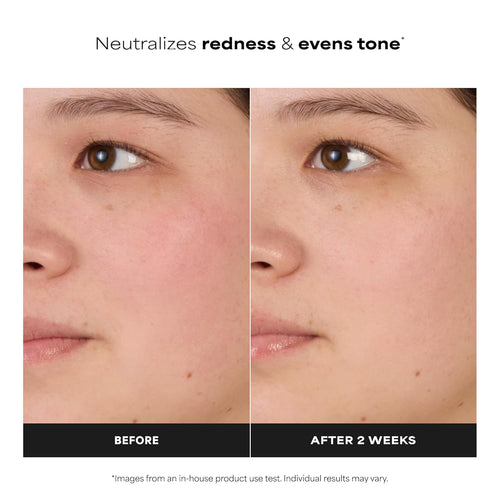Clear Skin Balancing Toner