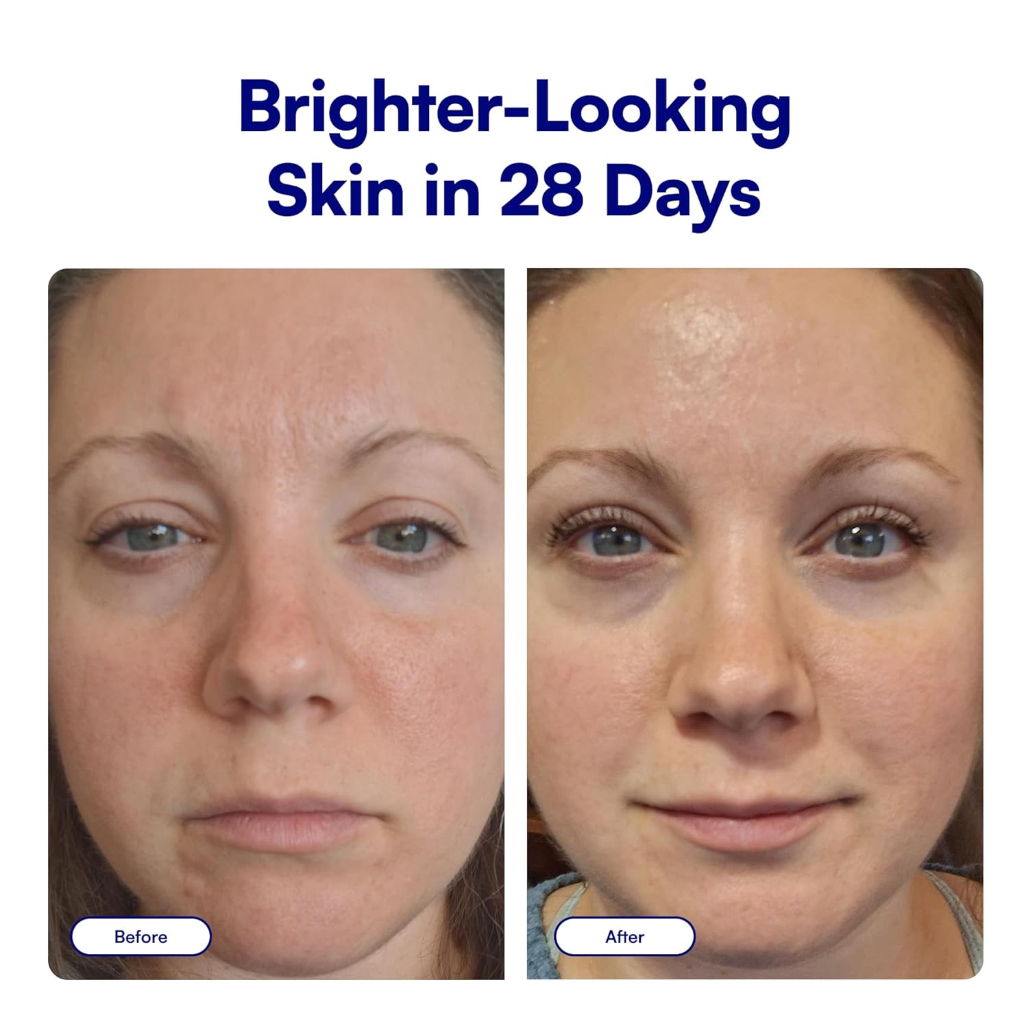 Glow Boost Face Serum