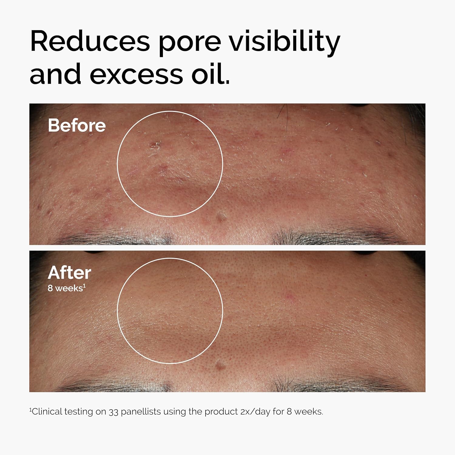 Before and after comparison of skin with pore visibility and excess oil reduction, showing clinical testing results.